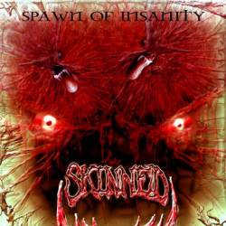 Skinned : Spawn of Insanity